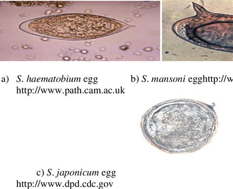  Schistosoma japonicum: 이 기생충은 몸속에 조용히 살지만 그 영향력은 정말 엄청나다!